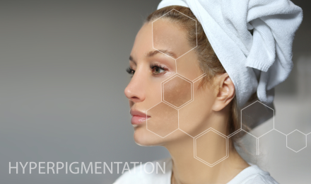 Κρέμα Νυκτός Luminous Care - Τριπλή δράση έναντι των πανάδων & δυσχρωμιών